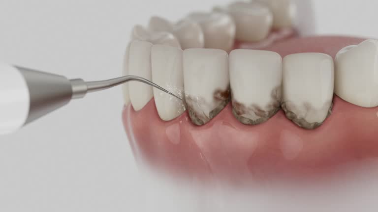 Reliable Dental Implants contractor in Grandview, IL by Smile Center Dentistry